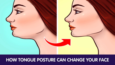 How Tongue Posture Can Change Your Face 1