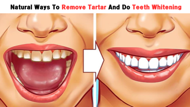 Natural Ways To Remove Tartar And Do Teeth Whitening At Home