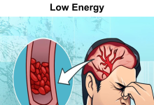 7 Things You Should Start Consuming If You Suffer From Headaches And Low Energy