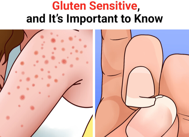 9 Signs You Might Be Gluten Sensitive and Its Important to Know2