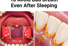 6 Effective Ways To Avoid Bad Breath Even After Sleeping