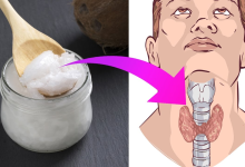 6 Ways Coconut Oil Can Benefit Those with Thyroid Problems