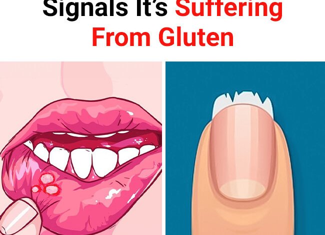 9 Clear Signs Your Body Sends When Its Suffering from Gluten