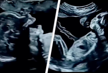 Amazing Footage Of What Babies Actually Do In The Womb Is Leaving People Stunned