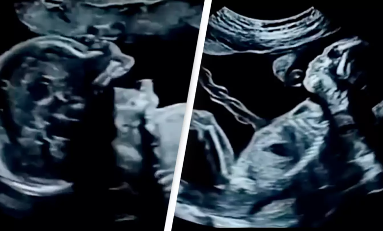 Amazing Footage Of What Babies Actually Do In The Womb Is Leaving People Stunned