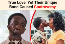 She Cant Kiss Him Man With No Jaw Found True Love Yet Their Unique Bond Caused Controversy