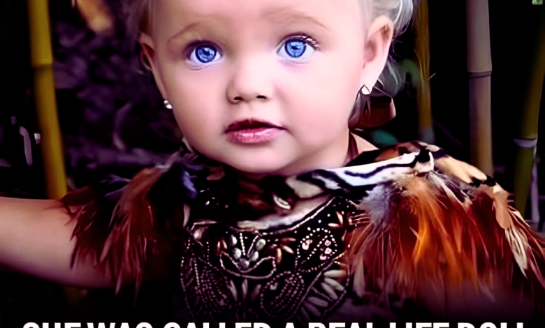 She Was Dubbed a RealLife Doll at Age 2aaa