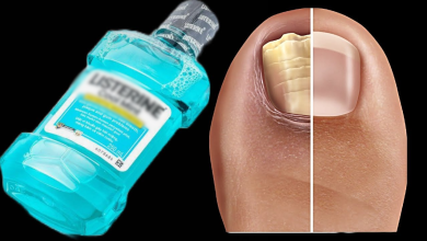 The Surprising Cure for Nail Fungus